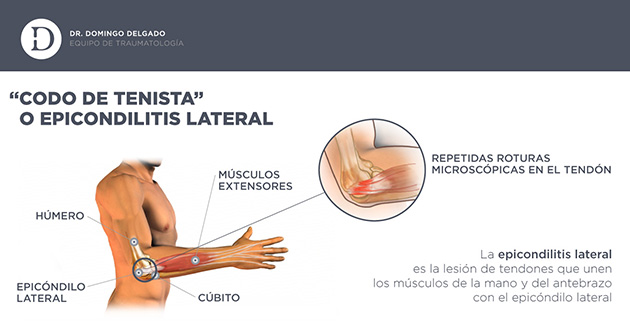 infografia_codotenista