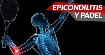 Las mejores palas del 2016 para evitar la epicondilitis